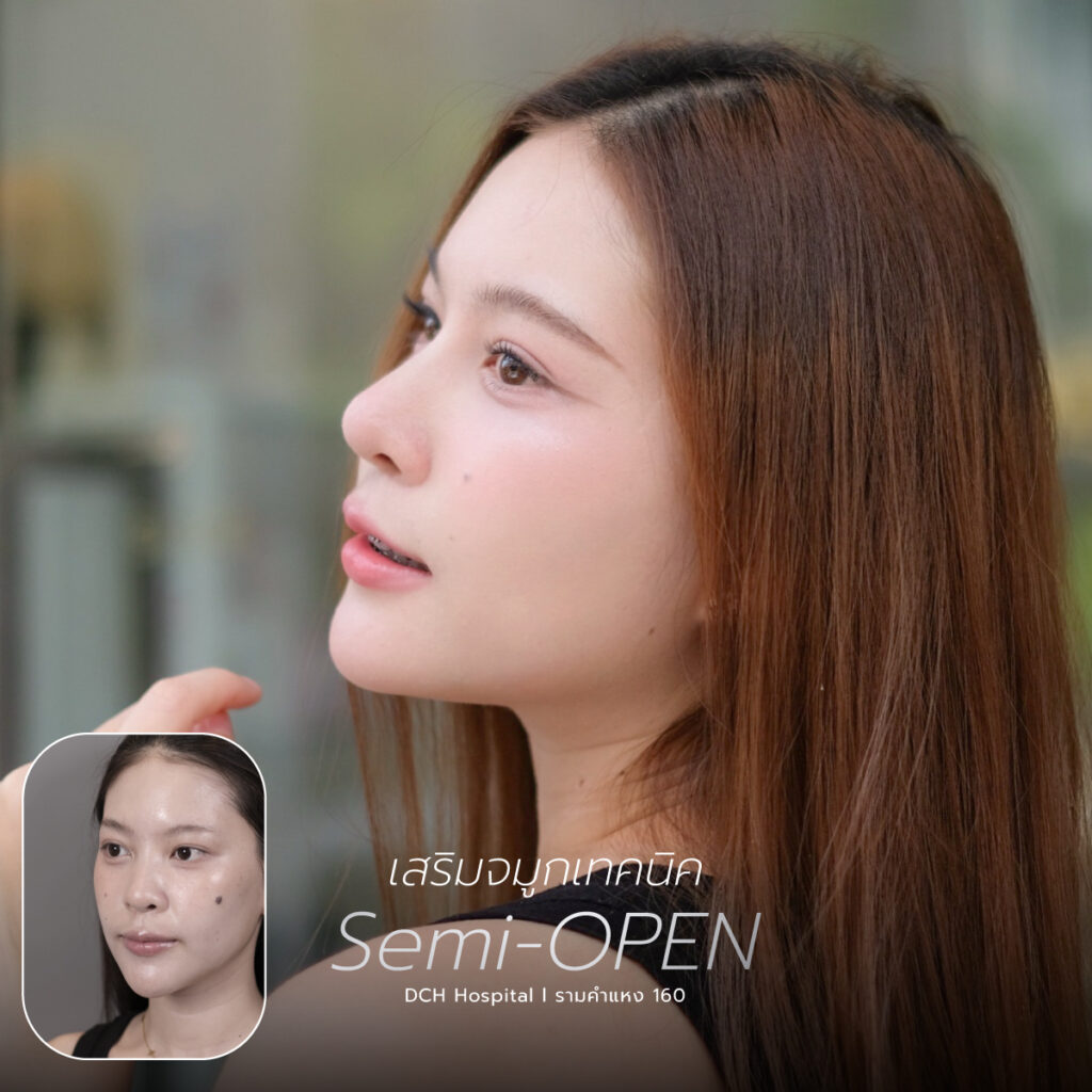 จมูก semi open
