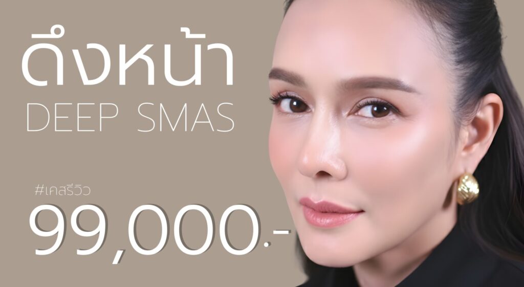 ดึงหน้า