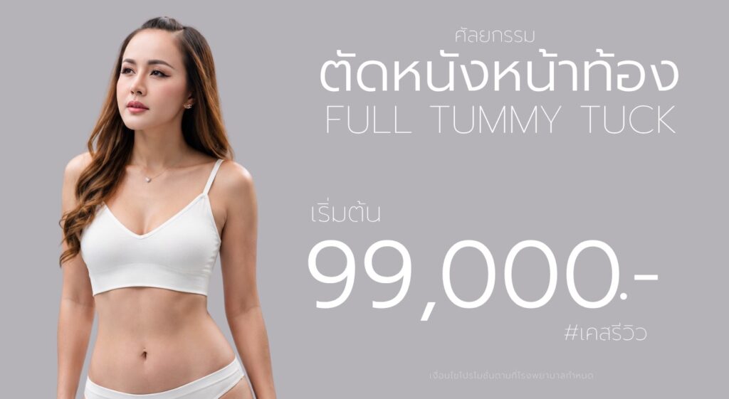 ตัดหนังหน้าท้อง