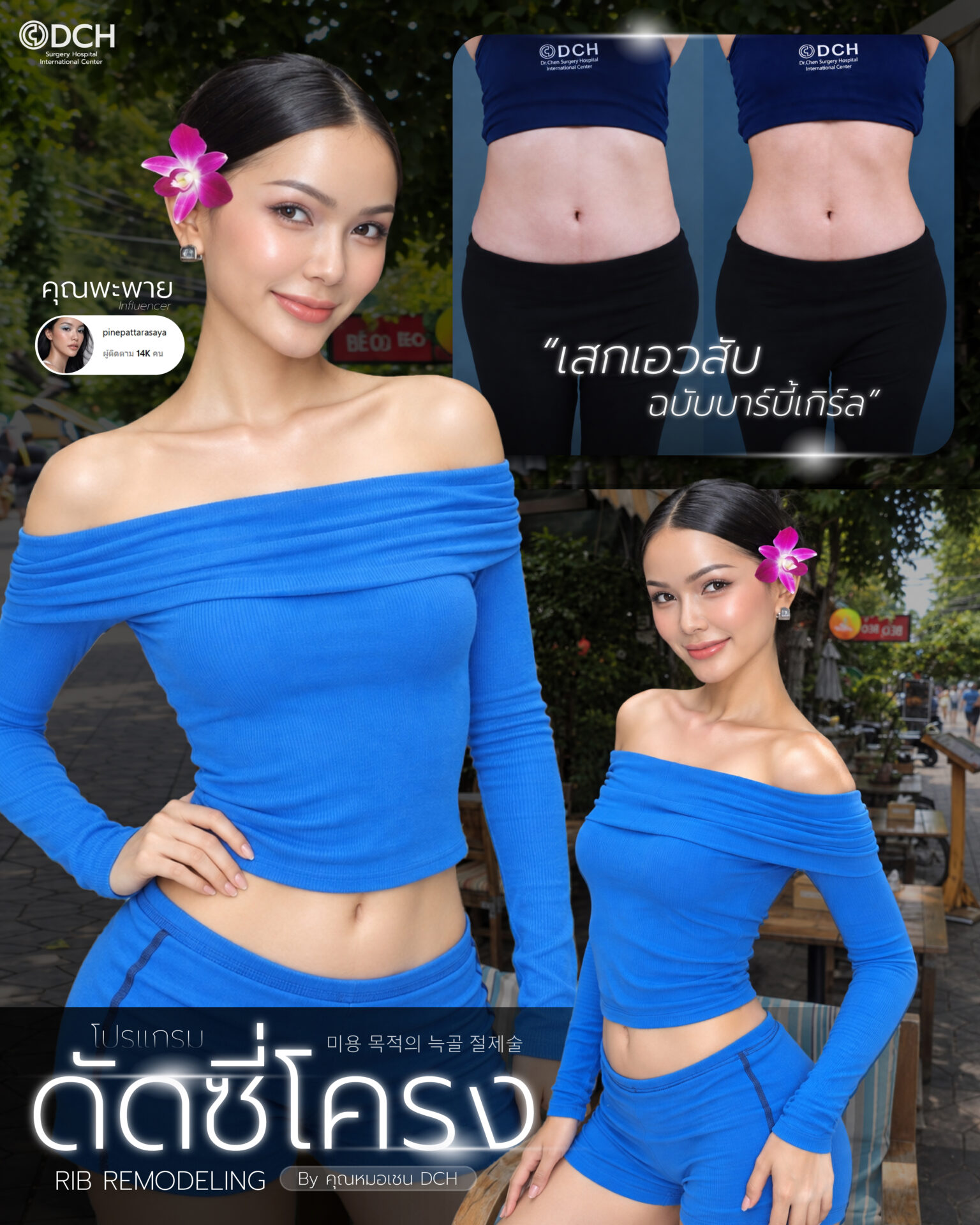 ดัดซี่โครง